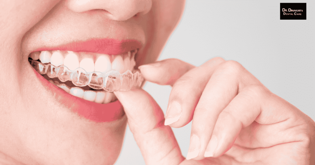 Invisalign in Iyyappanthangal