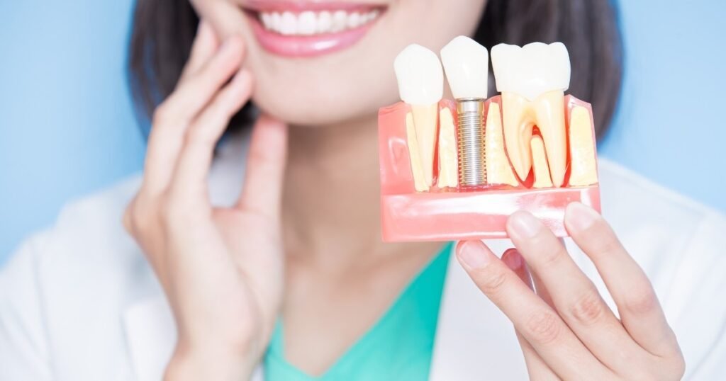 Dental Implants in Iyyappanthangal