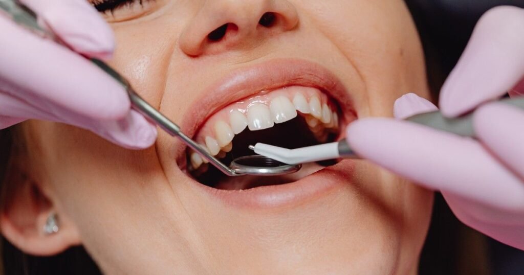 Teeth Alignment in Iyyappanthangal