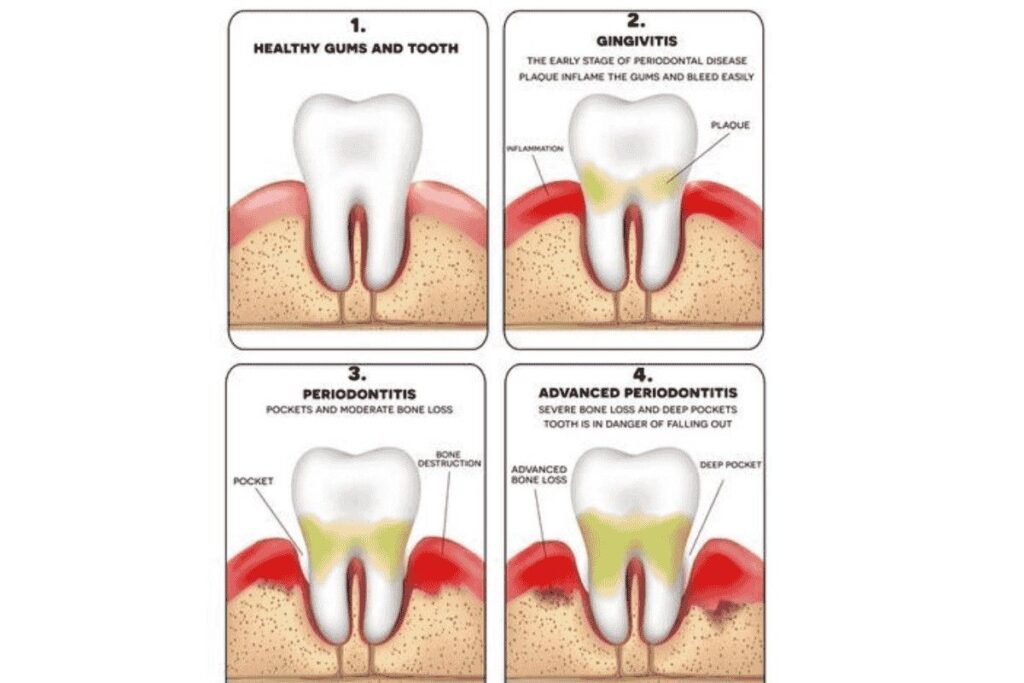 Tooth Pain Treatment in Iyyappanthangal