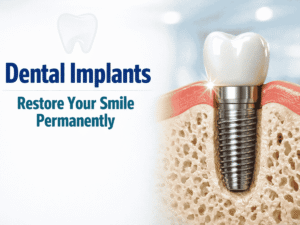 Dental Implants in Iyyappanthangal