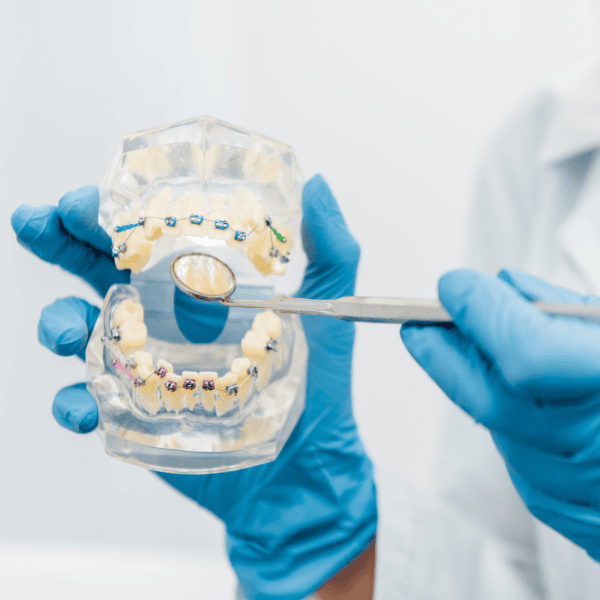 Teeth Replacement Image